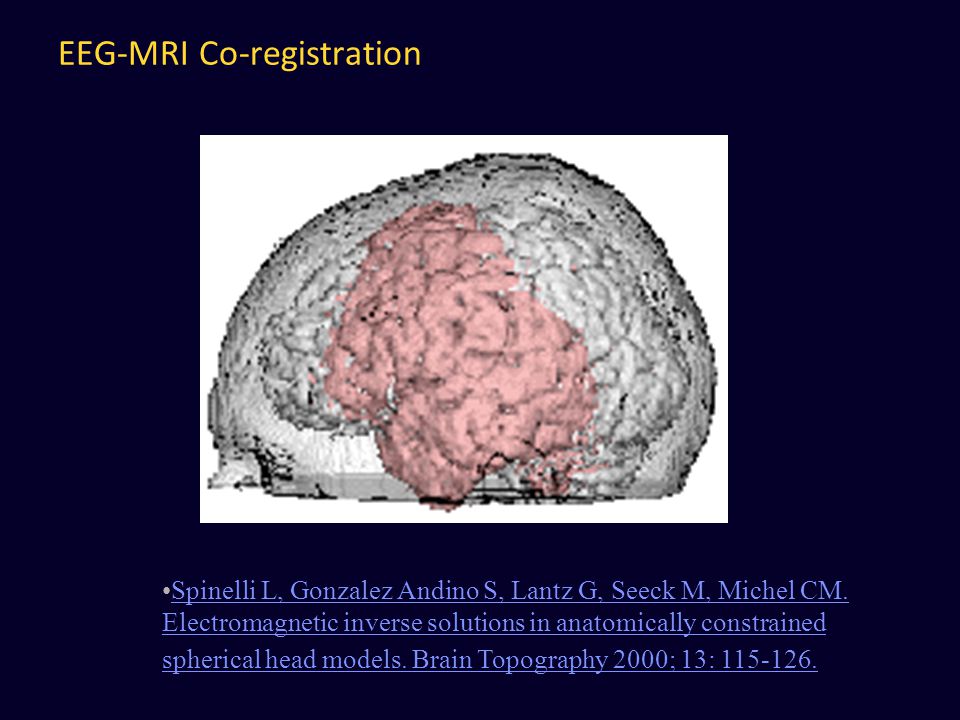 Brain Mapping and Functional Brain Imaging Ling 411 – ppt download