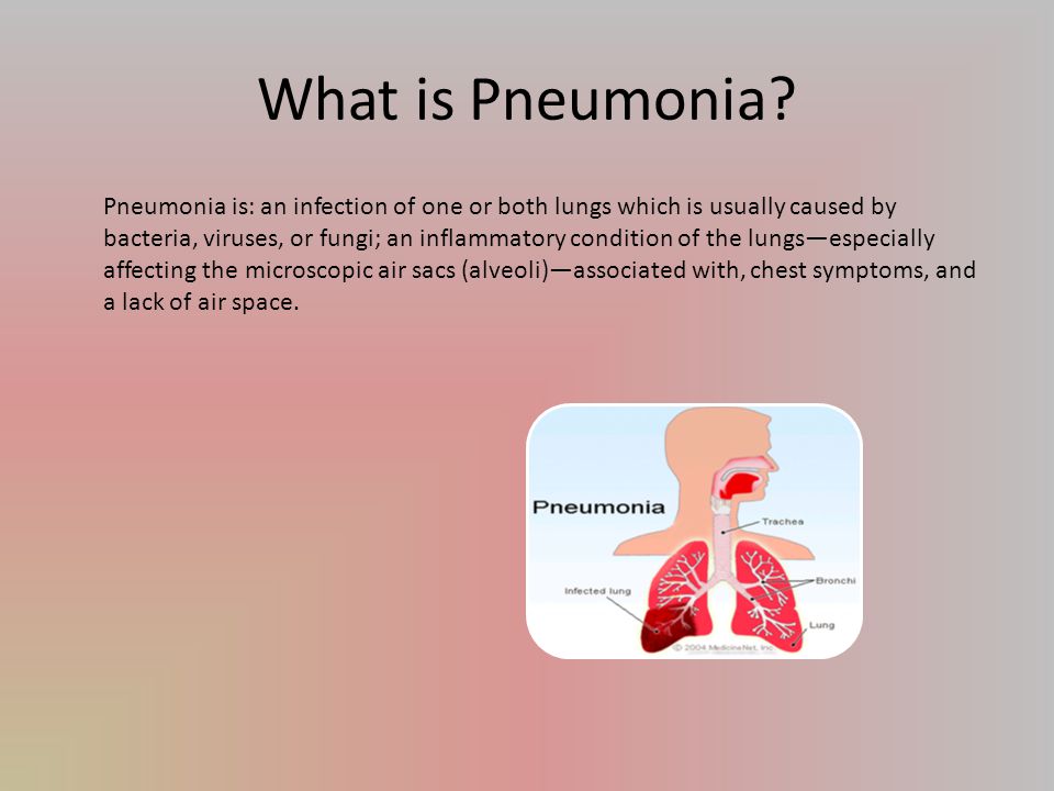 What is Pneumonia.
