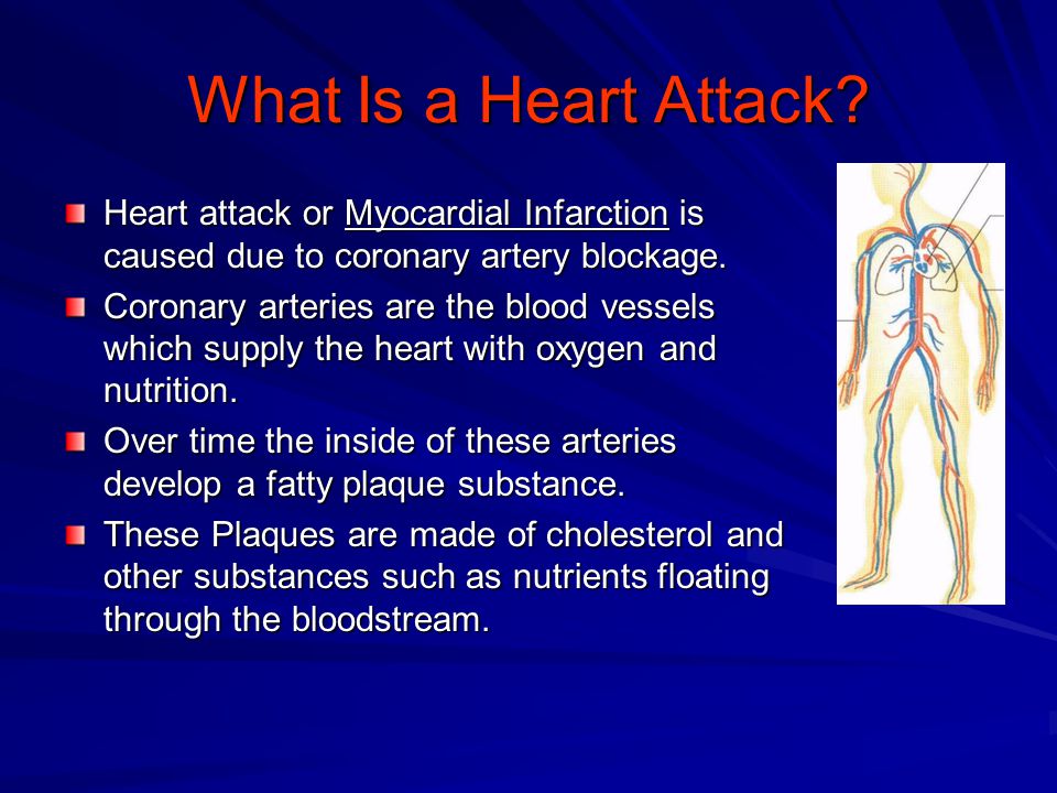 What Is a Heart Attack.