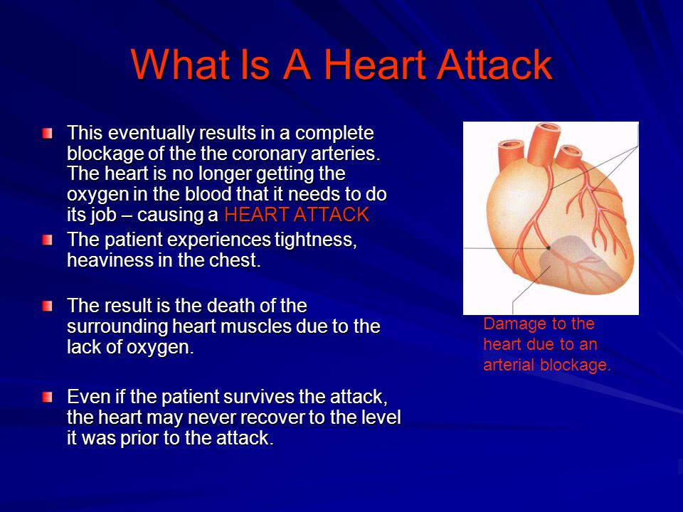 What Is A Heart Attack This eventually results in a complete blockage of the the coronary arteries.