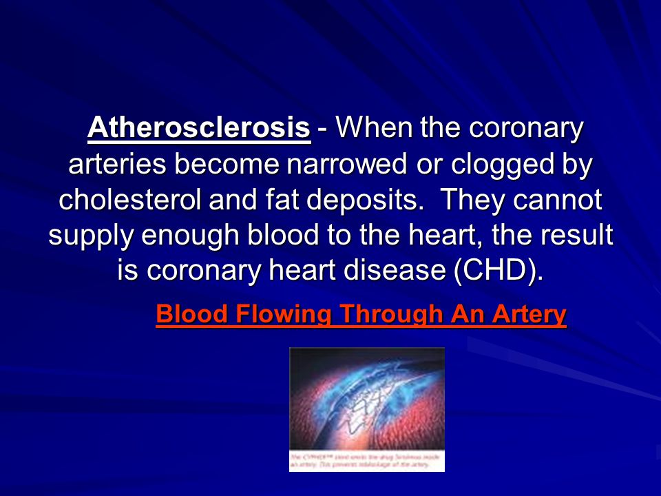 Atherosclerosis - When the coronary arteries become narrowed or clogged by cholesterol and fat deposits.