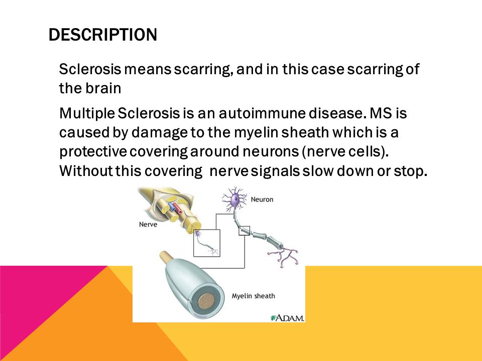 DESCRIPTION Sclerosis means scarring, and in this case scarring of the brain Multiple Sclerosis is an autoimmune disease.