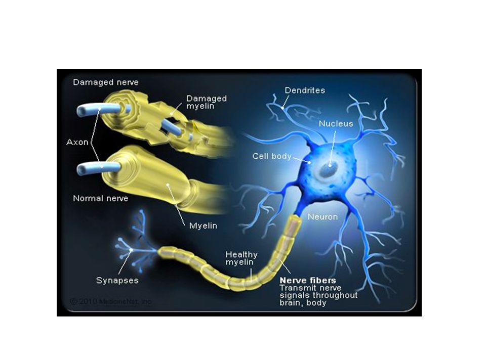 Повредили нерв после. Миелиновая оболочка при рассеянном склерозе. Демиелинизация нервных волокон. Строение миелиновой оболочки.