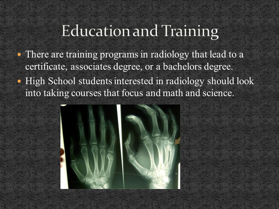 There are training programs in radiology that lead to a certificate, associates degree, or a bachelors degree.
