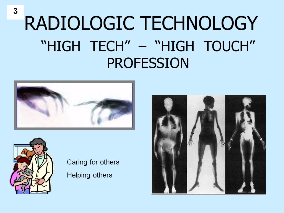 33 RADIOLOGIC TECHNOLOGY HIGH TECH – HIGH TOUCH PROFESSION Caring for others Helping others