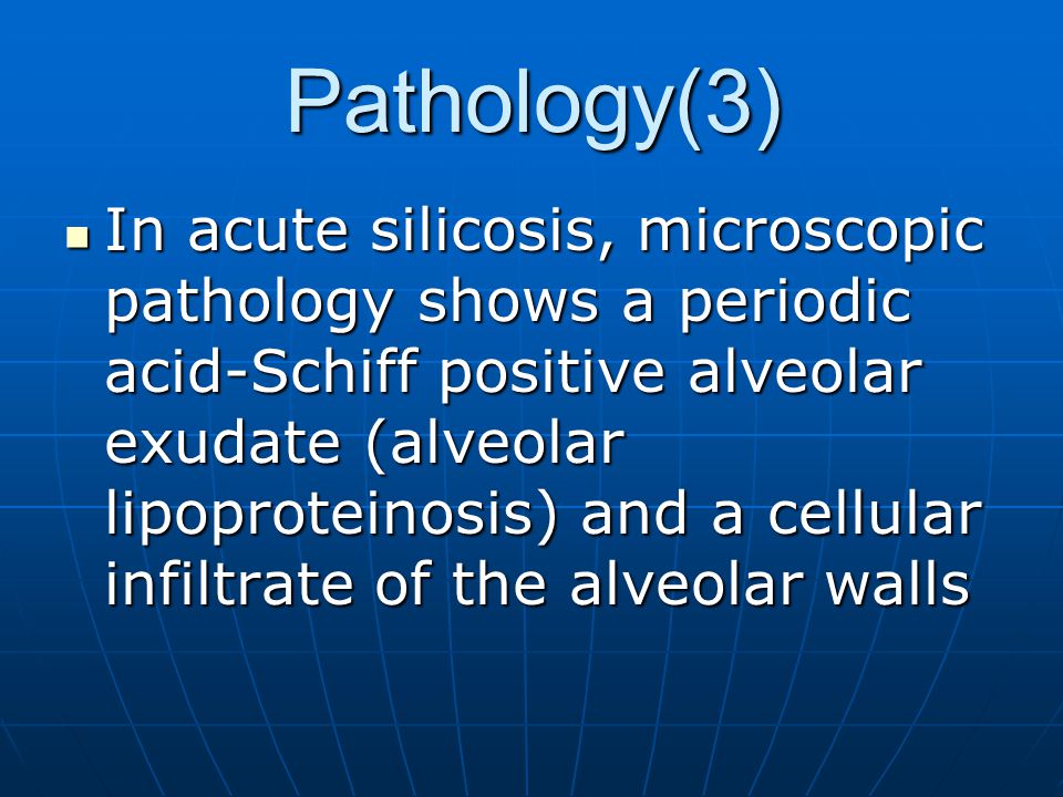Pathology(3) In acute silicosis, microscopic pathology shows a periodic acid-Schiff positive alveolar exudate (alveolar lipoproteinosis) and a cellular infiltrate of the alveolar walls In acute silicosis, microscopic pathology shows a periodic acid-Schiff positive alveolar exudate (alveolar lipoproteinosis) and a cellular infiltrate of the alveolar walls