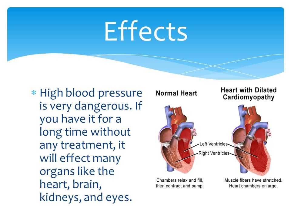  High blood pressure is very dangerous.
