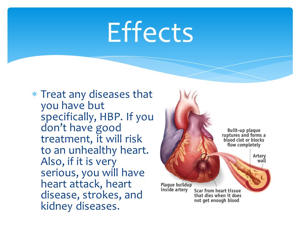  Treat any diseases that you have but specifically, HBP.