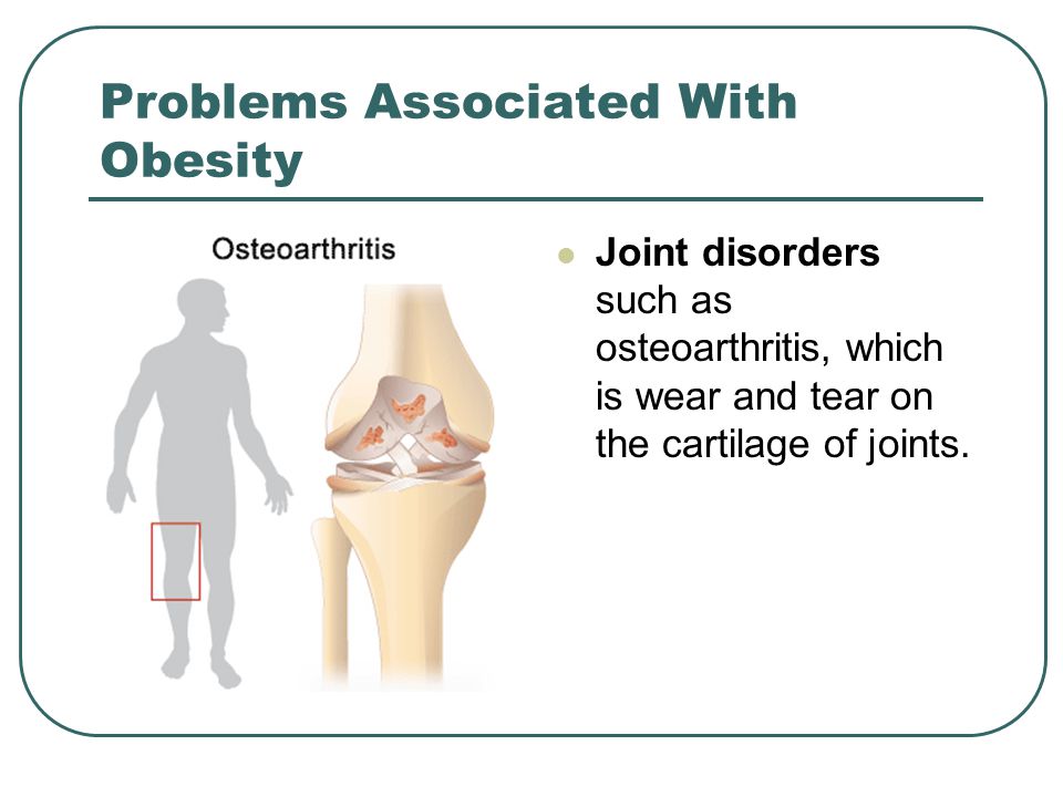 Problems Associated With Obesity Joint disorders such as osteoarthritis, which is wear and tear on the cartilage of joints.