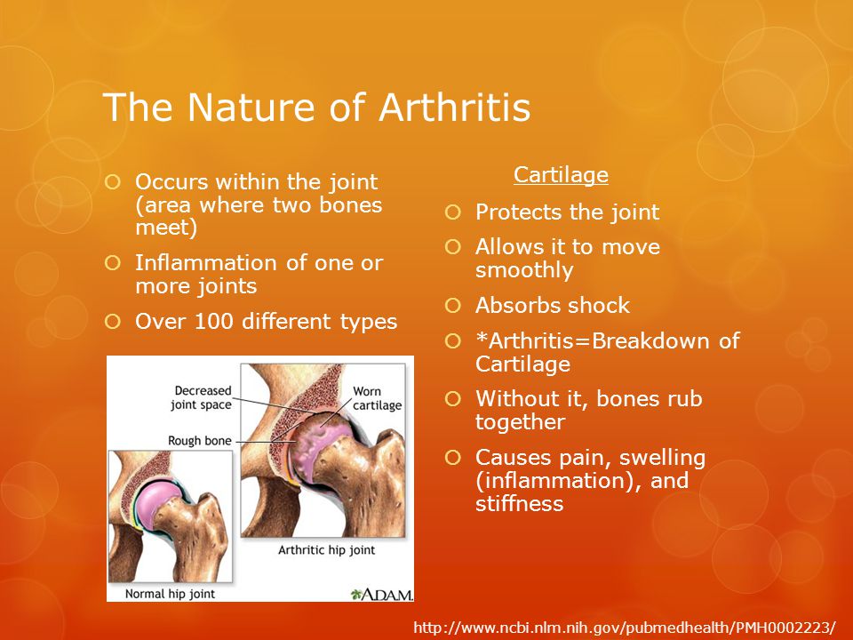 Arthritis and Stress… By Jack Schetter