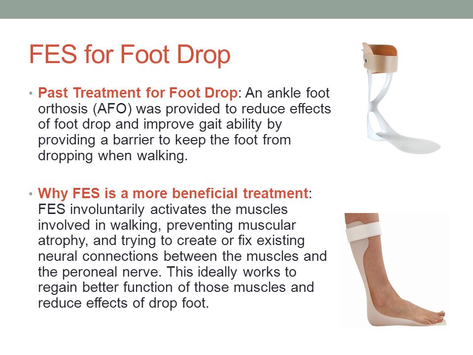 How to Treat Foot Drop with Electrical Stimulation Therapy
