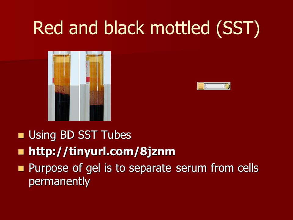 Red and black mottled (SST) Using BD SST Tubes Using BD SST Tubes     Purpose of gel is to separate serum from cells permanently Purpose of gel is to separate serum from cells permanently