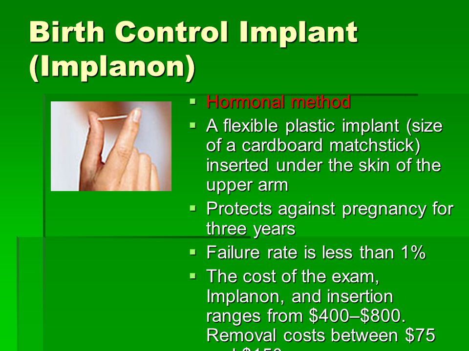Birth Control Implant (Implanon)  Hormonal method  A flexible plastic implant (size of a cardboard matchstick) inserted under the skin of the upper arm  Protects against pregnancy for three years  Failure rate is less than 1%  The cost of the exam, Implanon, and insertion ranges from $400–$800.