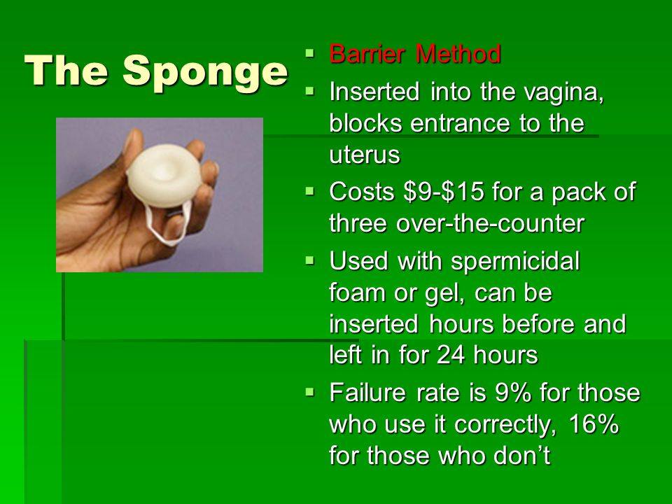 The Sponge  Barrier Method  Inserted into the vagina, blocks entrance to the uterus  Costs $9-$15 for a pack of three over-the-counter  Used with spermicidal foam or gel, can be inserted hours before and left in for 24 hours  Failure rate is 9% for those who use it correctly, 16% for those who don’t