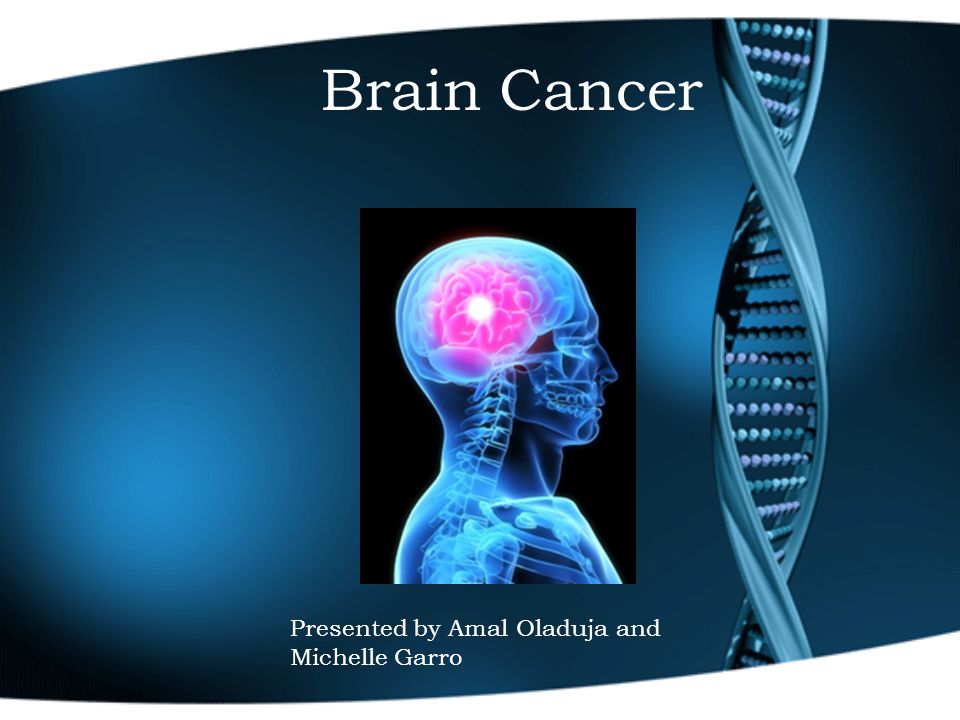 Brain Cancer Presented by Amal Oladuja and Michelle Garro