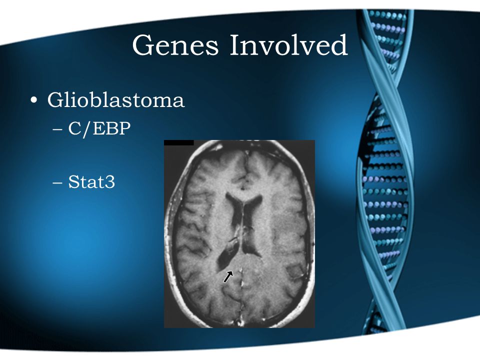 Genes Involved Glioblastoma –C/EBP –Stat3