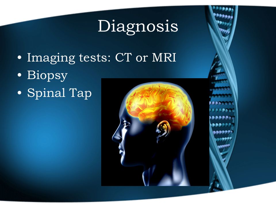 Diagnosis Imaging tests: CT or MRI Biopsy Spinal Tap
