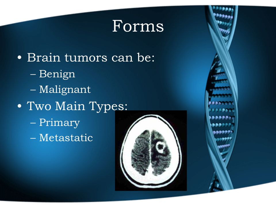 Forms Brain tumors can be: –Benign –Malignant Two Main Types: –Primary –Metastatic