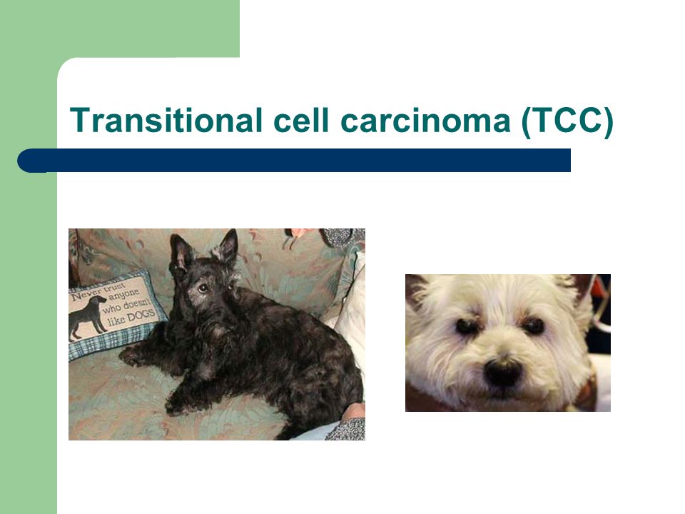 Transitional cell carcinoma (TCC)