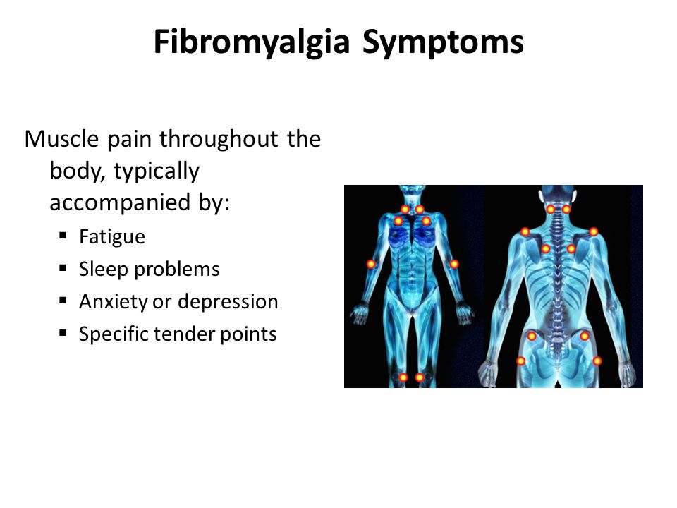 Фибромиалгия лечение симптомы причины заболевания. Фибромиалгия. Точки боли при фибромиалгии. Фибромиалгия патогенез. Фибромиалгия это аутоиммунное заболевание.