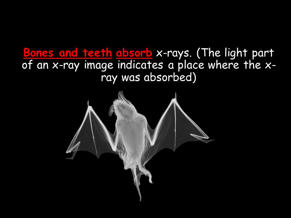 Bones and teeth absorb x-rays.