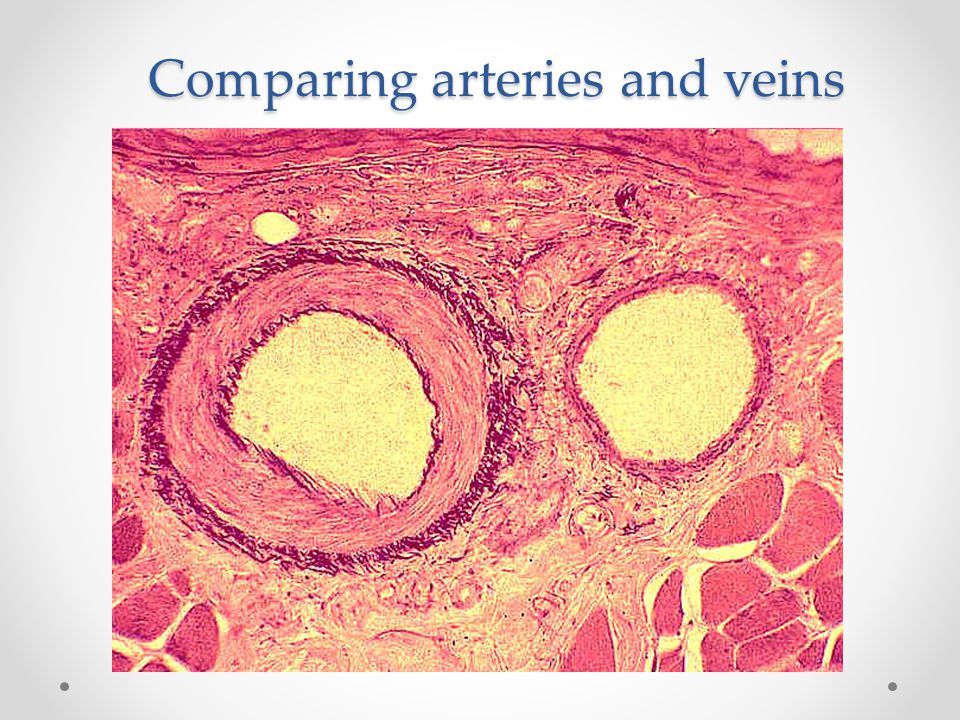 Comparing arteries and veins