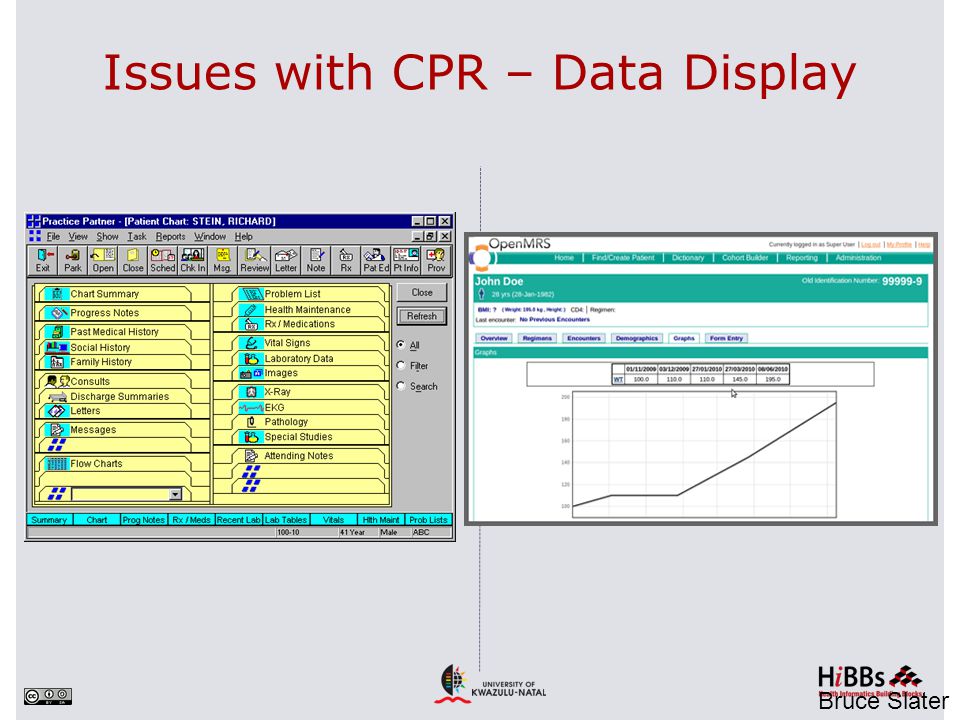 Issues with CPR – Data Display Bruce Slater