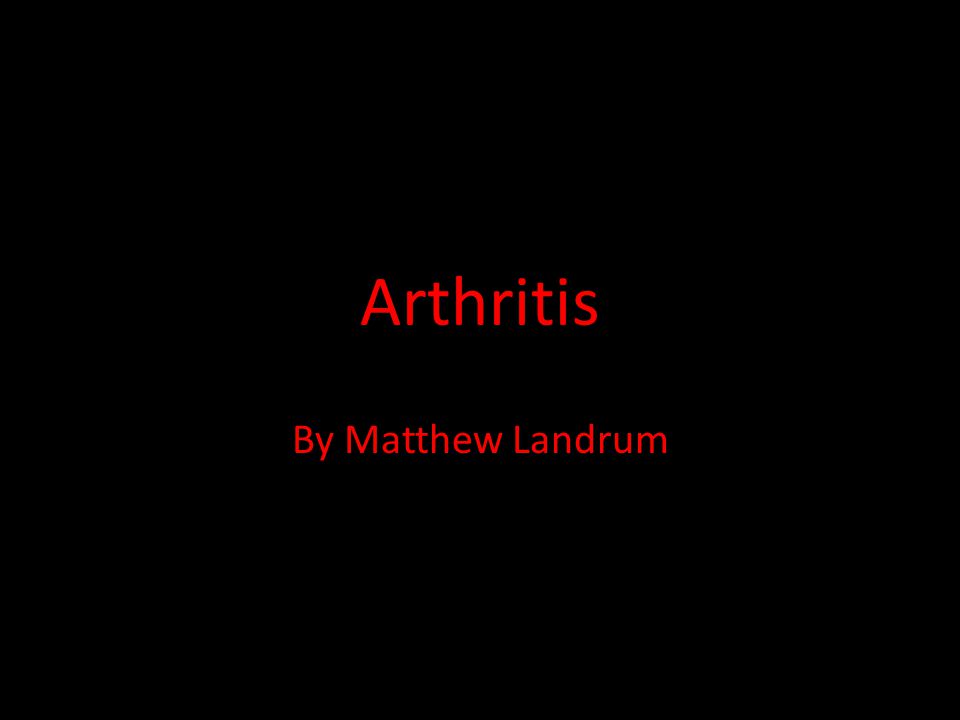 Arthritis By Matthew Landrum