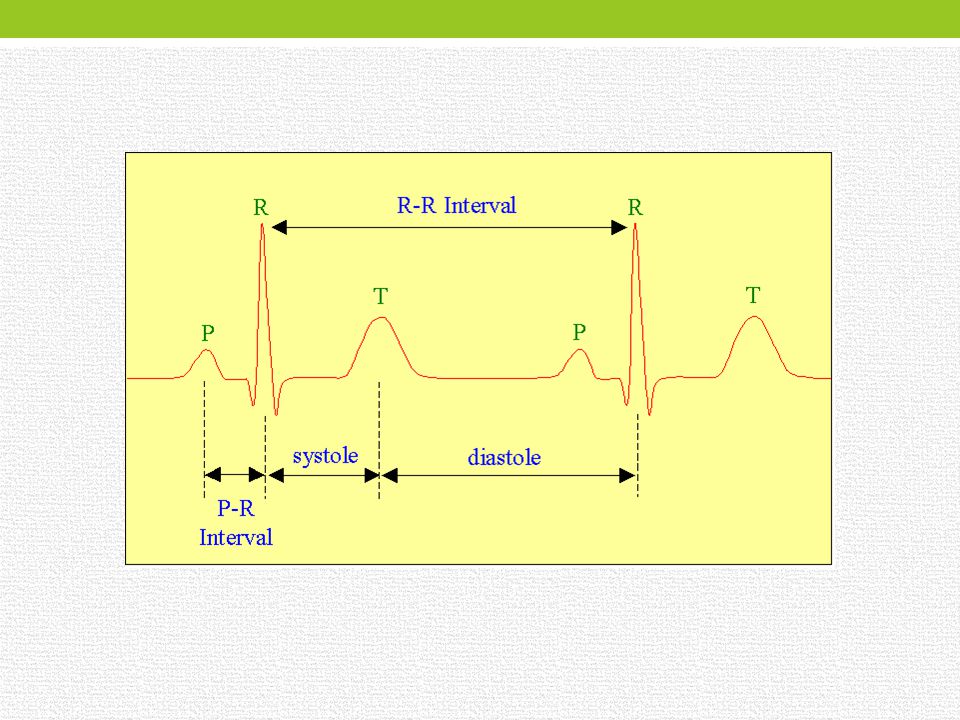 Сколько действительно экг. Диастола интервал ЭКГ. Интервал r-r ЭКГ. Электрическая диастола сердца.