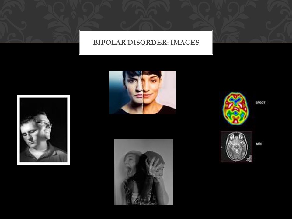 BIPOLAR DISORDER: IMAGES