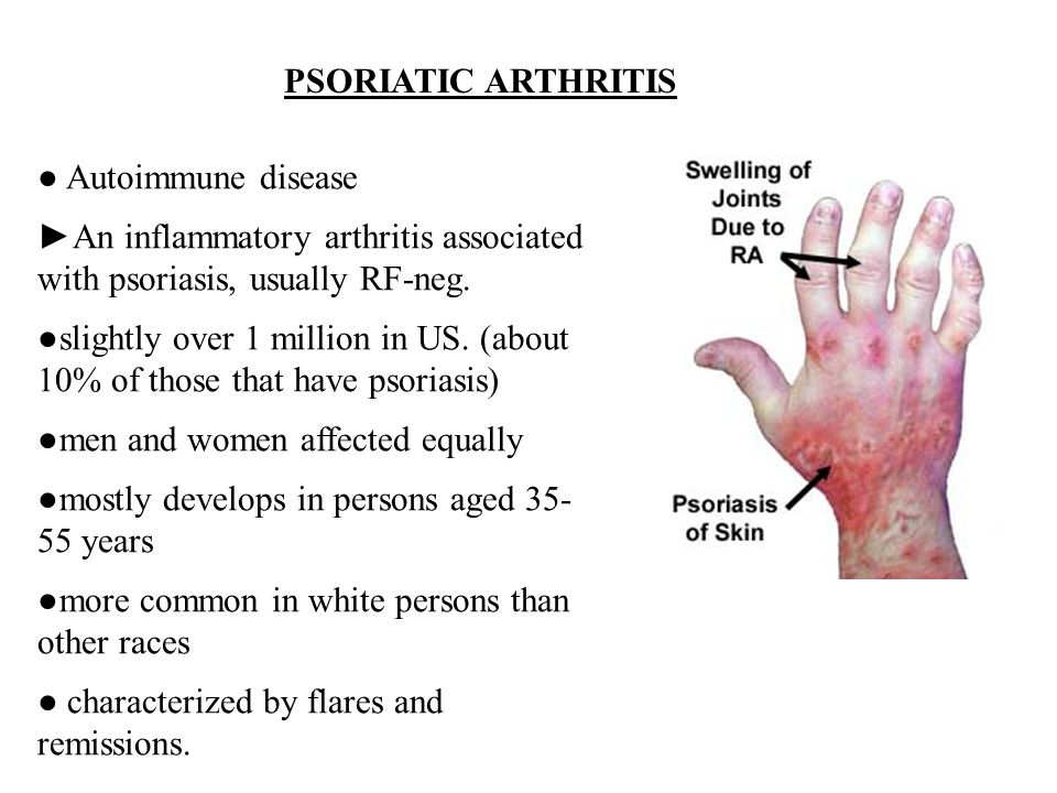 psoriatic arthritis autoimmune symptoms