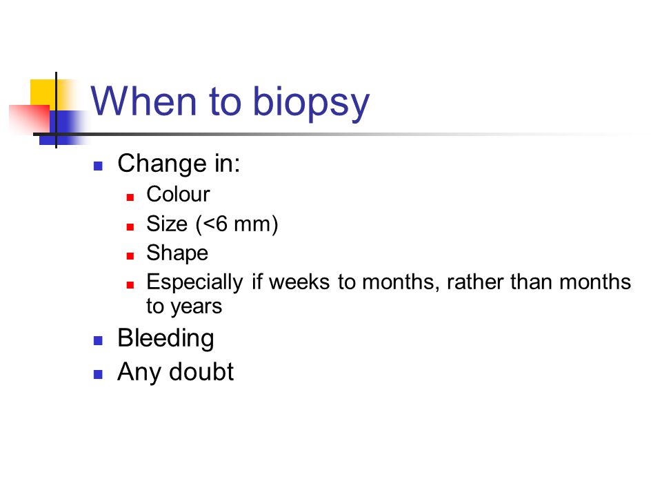When to biopsy Change in: Colour Size (<6 mm) Shape Especially if weeks to months, rather than months to years Bleeding Any doubt