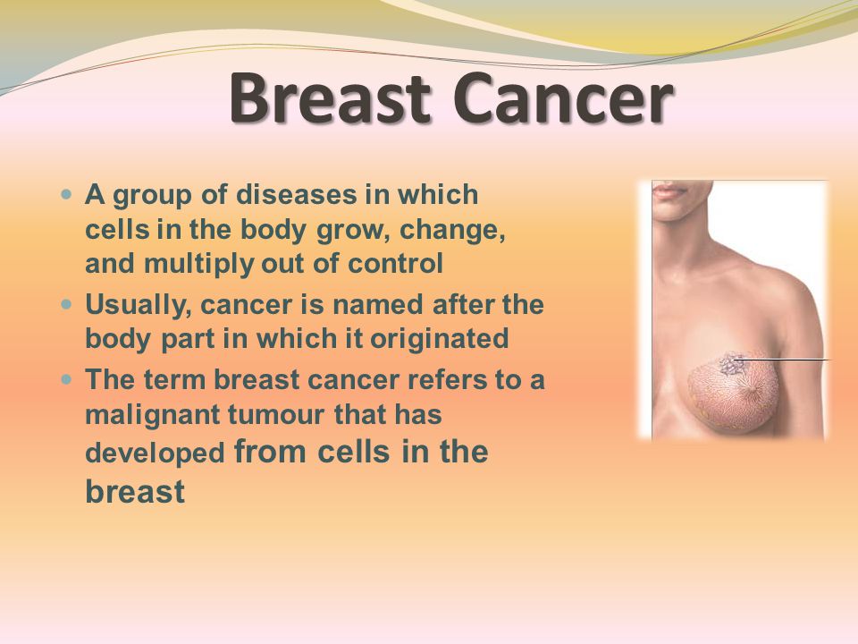 Breast Cancer A group of diseases in which cells in the body grow, change, and multiply out of control Usually, cancer is named after the body part in which it originated The term breast cancer refers to a malignant tumour that has developed from cells in the breast