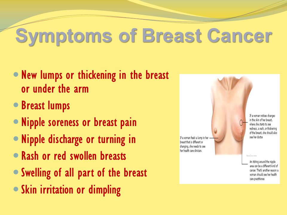 Symptoms of Breast Cancer New lumps or thickening in the breast or under the arm Breast lumps Nipple soreness or breast pain Nipple discharge or turning in Rash or red swollen breasts Swelling of all part of the breast Skin irritation or dimpling
