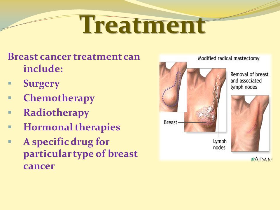 Treatment Breast cancer treatment can include:  Surgery  Chemotherapy  Radiotherapy  Hormonal therapies  A specific drug for particular type of breast cancer