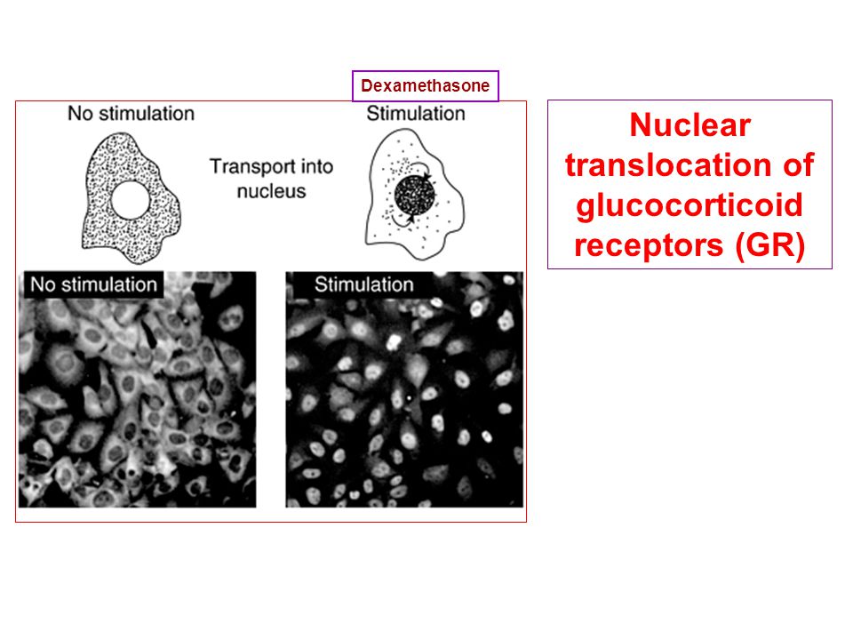 Nuclear translocation of glucocorticoid receptors (GR) Dexamethasone