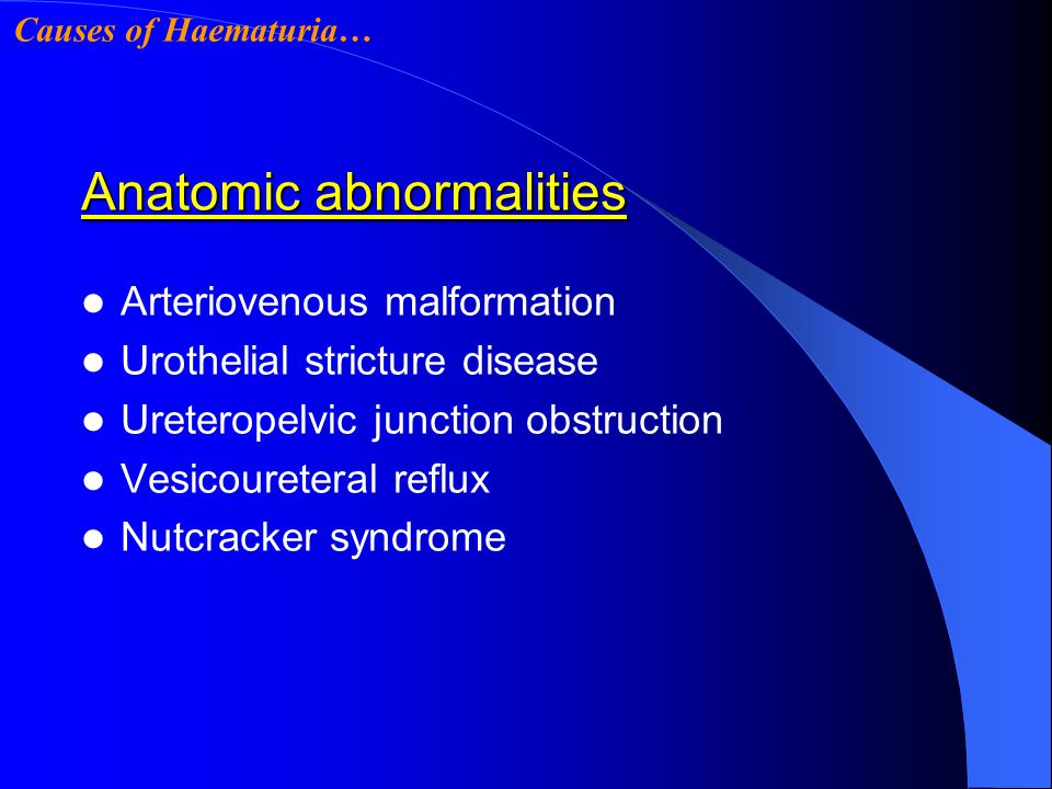 Loin pain haematuria syndrome –