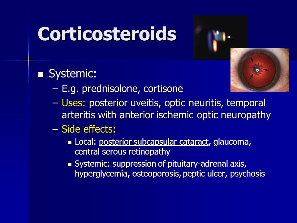 Corticosteroids Systemic: Systemic: –E.g.