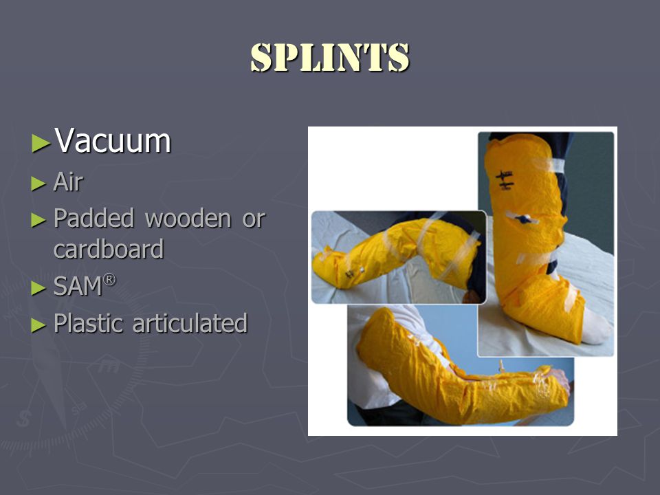 Splints ► Vacuum ► Air ► Padded wooden or cardboard ► SAM ® ► Plastic articulated