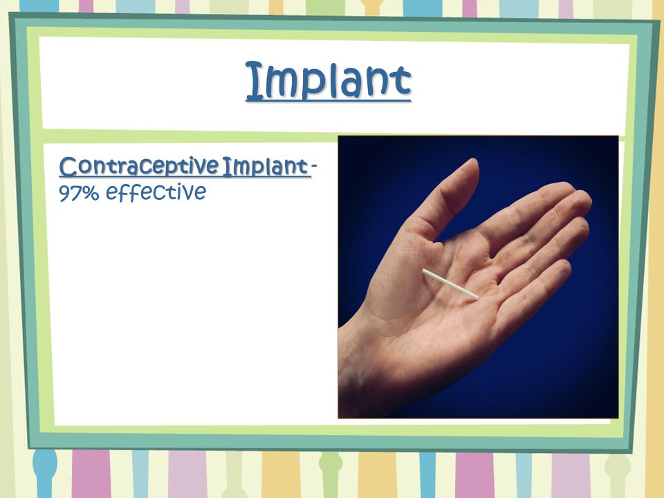Implant Contraceptive Implant Contraceptive Implant - 97% effective