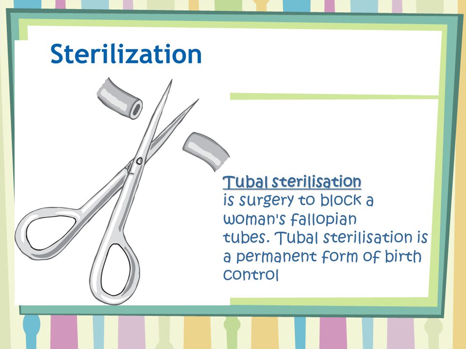 Tubal sterilisation is surgery to block a woman s fallopian tubes.