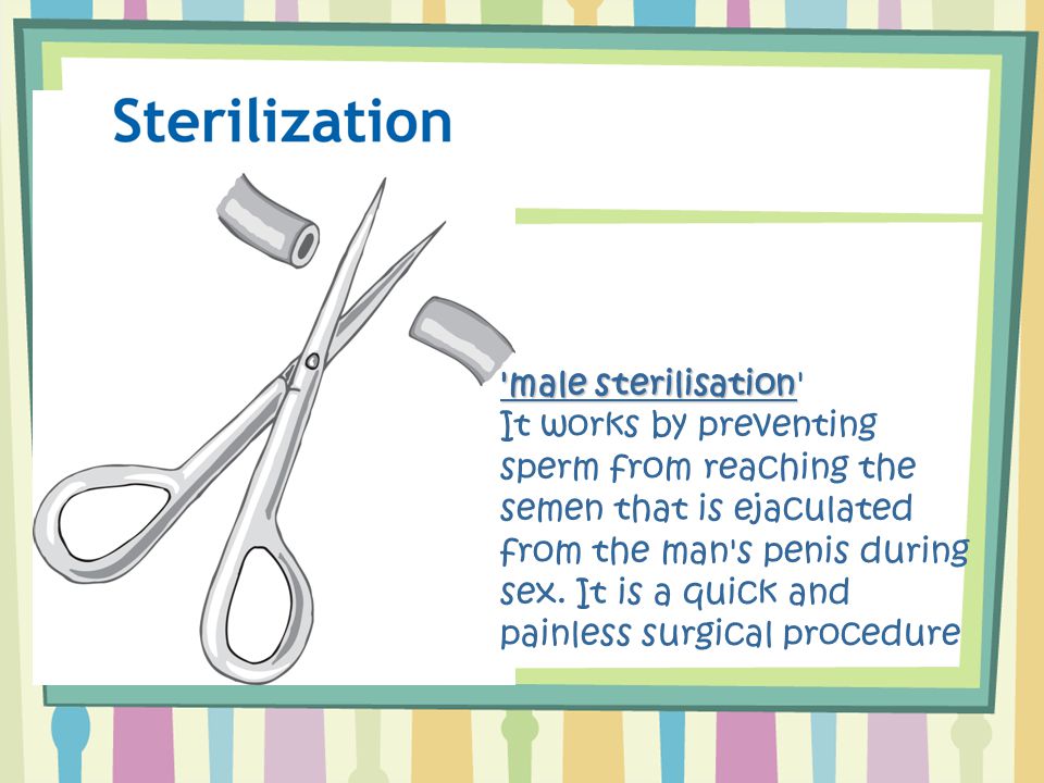 male sterilisation male sterilisation It works by preventing sperm from reaching the semen that is ejaculated from the man s penis during sex.