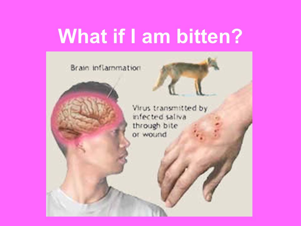 What if I am bitten