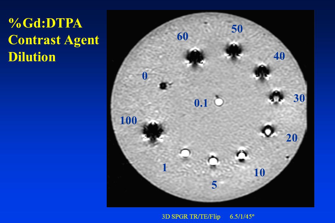 %Gd:DTPA Contrast Agent Dilution 3D SPGR TR/TE/Flip 6.5/1/45º