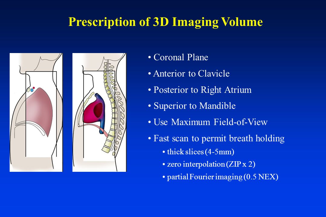 Coronal Plane Anterior to Clavicle Posterior to Right Atrium Superior to Mandible Use Maximum Field-of-View Fast scan to permit breath holding thick slices (4-5mm) zero interpolation (ZIP x 2) partial Fourier imaging (0.5 NEX) Prescription of 3D Imaging Volume