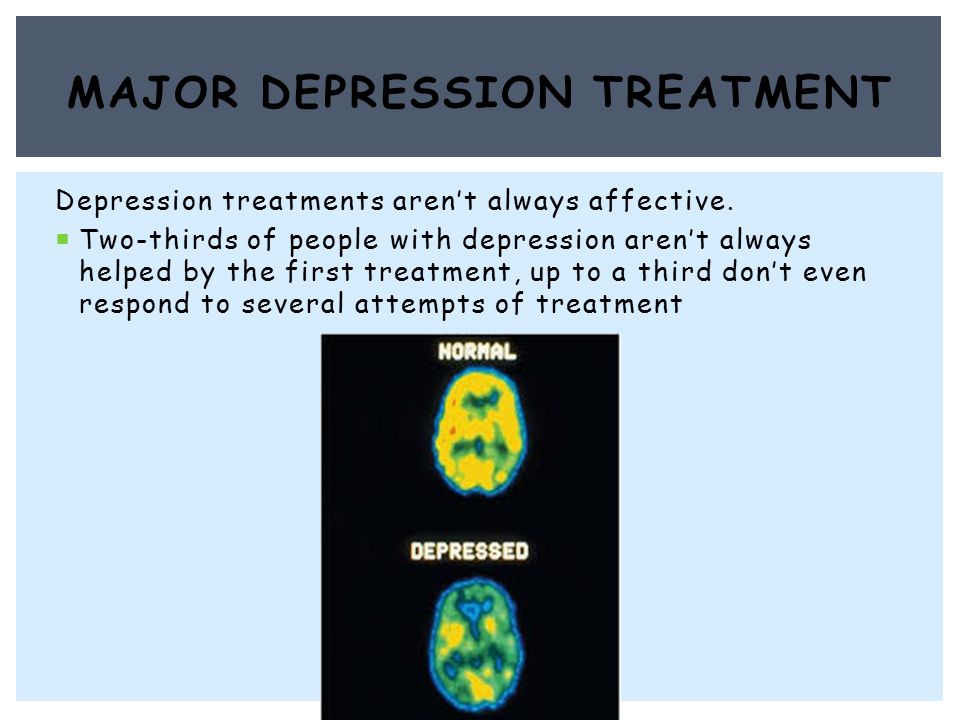 Depression treatments aren’t always affective.
