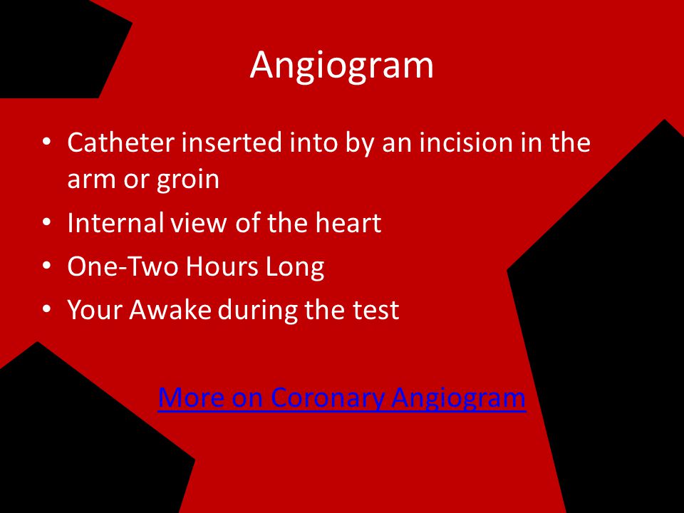 Treatment & Test Angiography Angioplasty Bypass Surgery