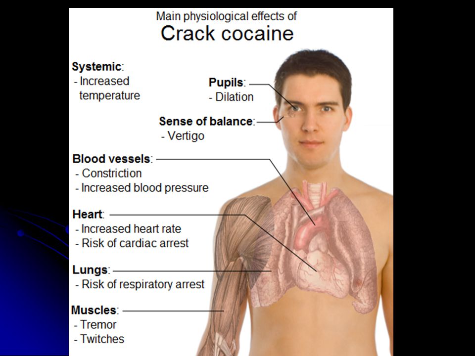 Crack Crack is when individuals’ free base cocaine Crack is when individuals’ free base cocaine This is burning the substance and inhaling the fumes This is burning the substance and inhaling the fumes Because this is so potent it has SHORT but powerful effects ( these effects occur within 8 seconds of being smoked) Because this is so potent it has SHORT but powerful effects ( these effects occur within 8 seconds of being smoked)