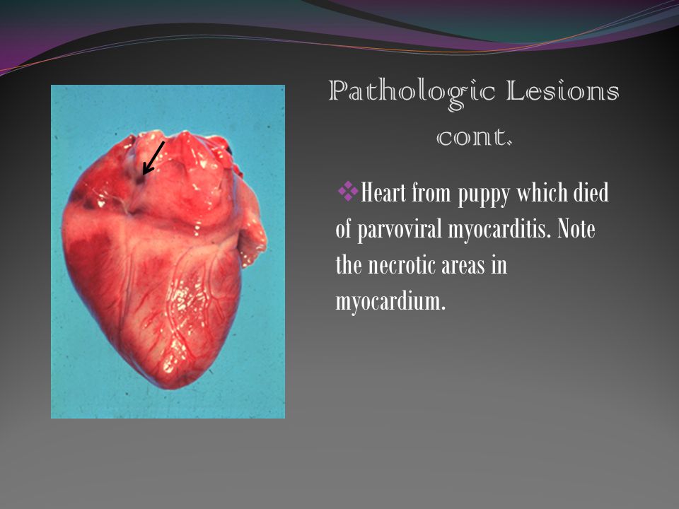 Pathologic Lesions cont.  Heart from puppy which died of parvoviral myocarditis.