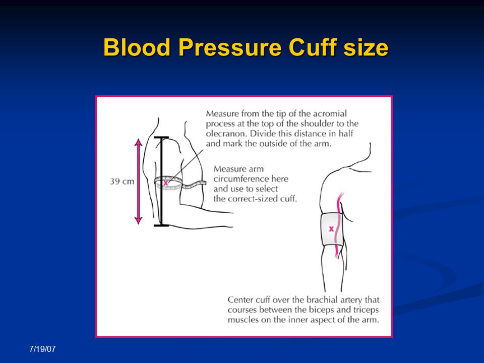 Choosing the Right-size Cuff